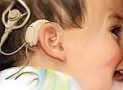 Más de un centenar de niños hipoacúsicos han recuperado aquí la audición gracias a un novedoso método quirúrgico que al parecer será la solución para pacientes con otitis media serosa, una enfermedad que se manifiesta con frecuencia en los primeros años de